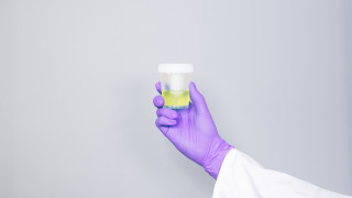 Gloved hand holding a laboratory sample container with liquid, photograph.