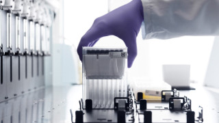 Gloved hand loading blood sample tubes into an automated laboratory analysis system, photograph.