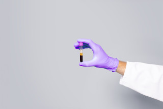 Laboratory specialist's hand holding a blood sample tube.