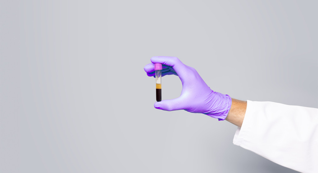 Laboratory specialist's hand holding a blood sample tube.