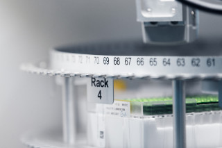 Close-up of blood sample tubes arranged in an automated laboratory rack, photograph.